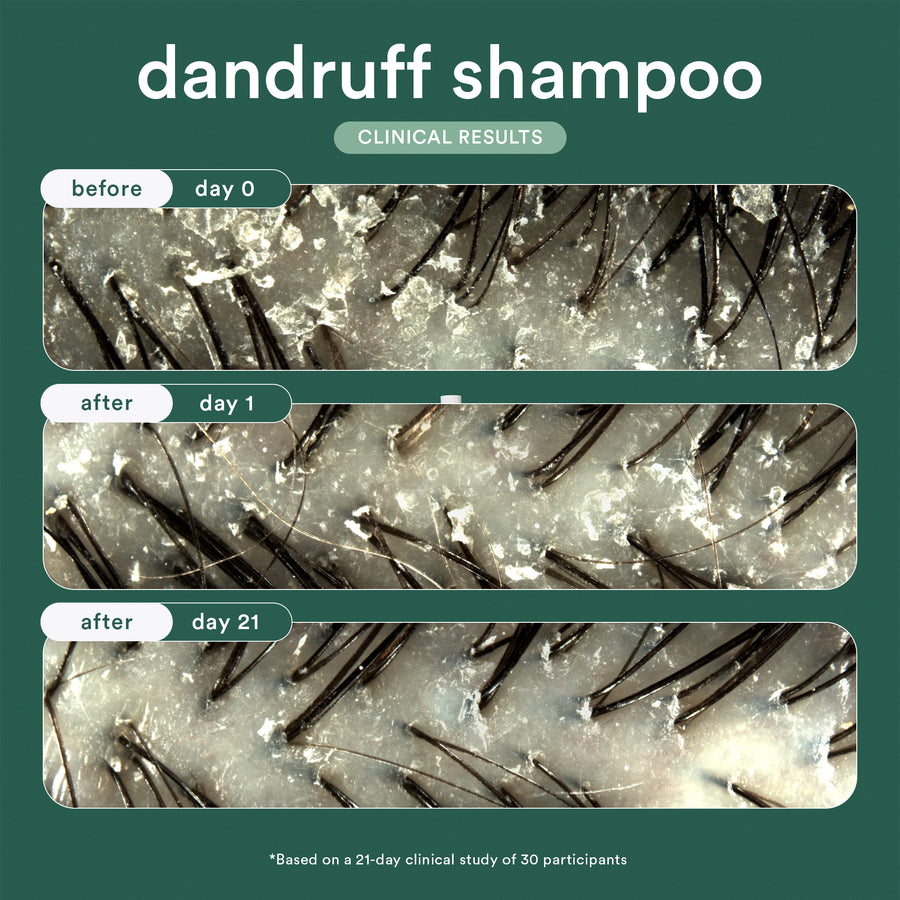 dandruff shampoo